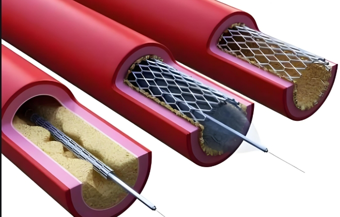 Sơ đồ phát hiện rò rỉ ống thôn